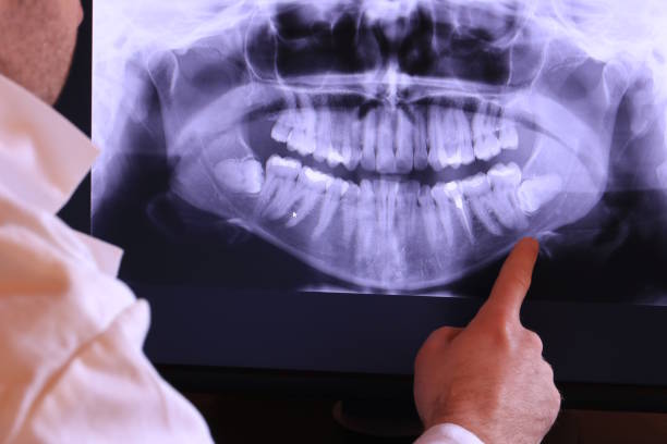 Best Broken or Chipped Tooth Repair in Alpine, NJ